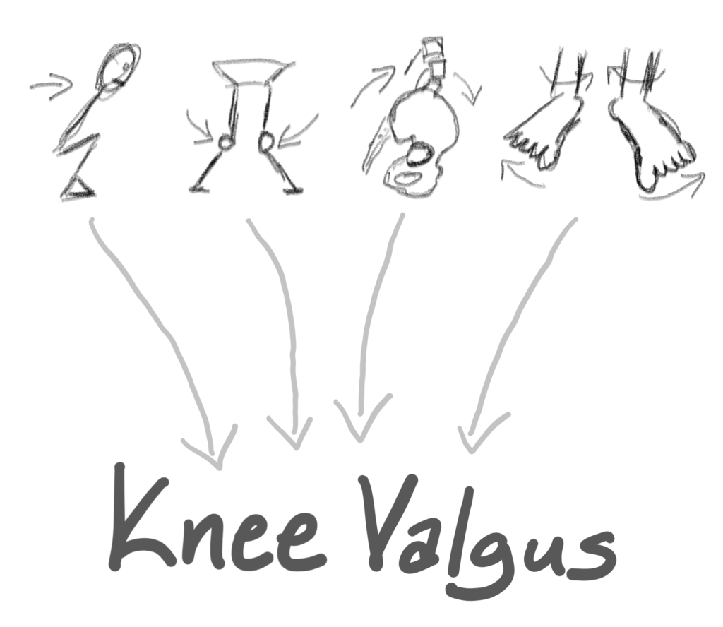 Forward weight shift, knee collapsing, anterior pelvic tilt, and foot issues can ALL present as knee valgus.